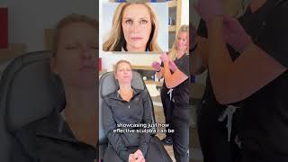 Sculptra Training at NeoWell