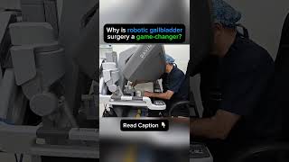 Why Robotic Gallbladder Surgery Is a Game Changer? #shorts #shortvideo #roboticsurgery