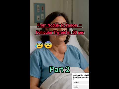 Follicular carcinoma|thyroid cancer 😱|General surgery|NEET MDS#shorts#facts#ytshorts#1000subscriber