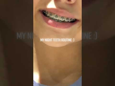 Ortho-buddy nightly routine #shorts #orthobuddy