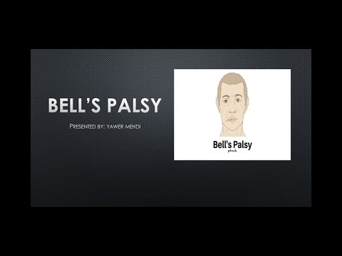 Bell's palsy