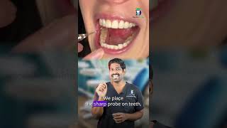 Which property should be sealed - Probing depth on decay | Dr.Karthikeyan | Denta Kings