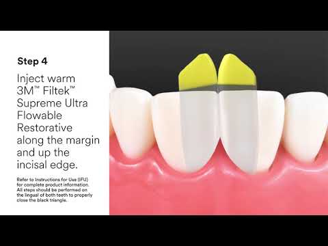 3M and Bioclear: A Match for Modern Dentistry