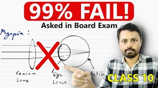 😱 This 5-Mark Question is 100% Coming in Your Board Exam! | human eye class 10 | #board2026