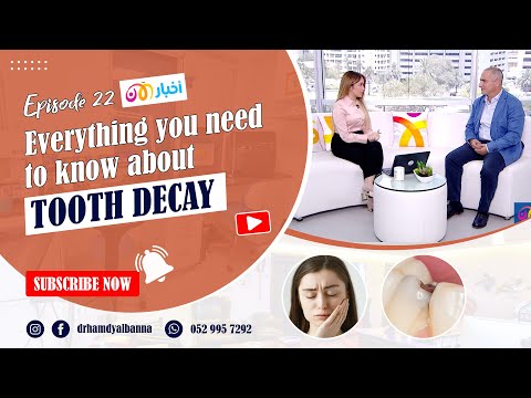 All you need to know about Tooth Decay  | Dr. Hamdy Al Banna | German Dental Center