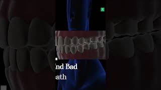 End Bad Breath With This Easy Natural Recipe!