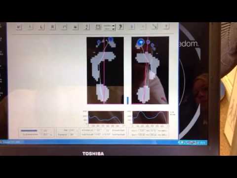 Early Heel Lift on a Short Leg - Sub-4 Biomechanics