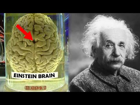 Unlocking Einstein's Genius: How Einstein's Brain Was Different | The Scientific Exploration