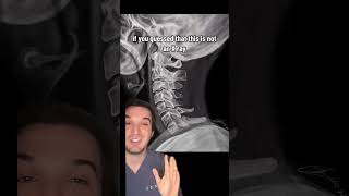 #medtok #meded #medicaleducation #tiktokdoc #radiology #radiologist #medicine #doctor #medstudent