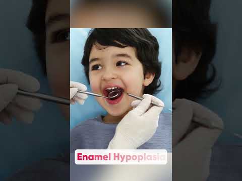 बच्चों में Enamel Damage ka karan aur ilaj | Enamel Damage: Causes & Treatment | Dr Navita Sharma