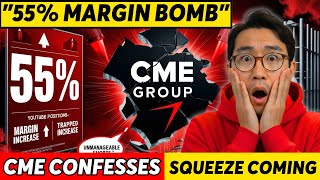 THE CONFESSION: CME Admits "Unmanageable Shorts" Panic as 55% Margin Bomb Backfires – Lease Rates
