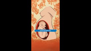 Breech Baby On Board? Why C-Section Is Now The Safer Route