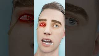 The Man With A Two-Carat Diamond Eye 😳 Surgeon Reacts