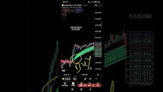 09/04/2025 XAUUSD LIVE TRADE #goldtrading #trading #bestgoldforexsignals #crypto #tradewithvillain
