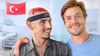 I Gave My Balding Friend A Hair Transplant