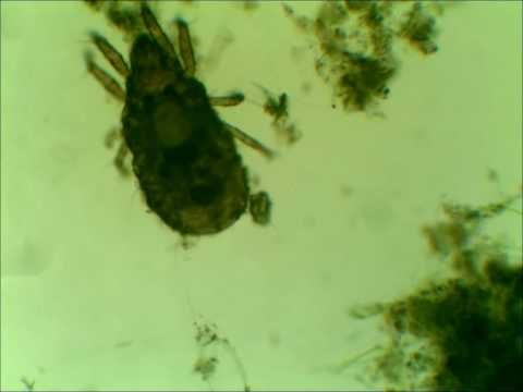 House Mite under microscope