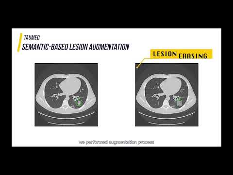 TauMed: Test Augmentation of Deep Learning in Medical Diagnosis