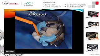 Dr. Snyder on Injectable Composites