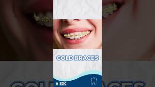 Is there gold braces ? | தங்க ப்ராசஸ் | Affordable Aligners in Chennai