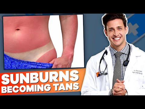 Why Don't Sunburns Become Tans