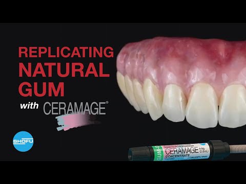 Replicating the natural gum with Ceramage