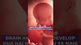 Why Every Pregnant Mom Should Know About the NT Scan 🩺✨ #baby #pediatrichealth #shorts