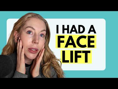 I HAD A FACELIFT IN MY 40's...