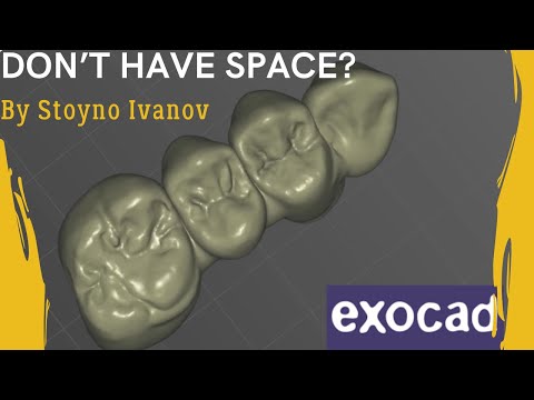 Anatomic Bridge - If You Don’t Have Space