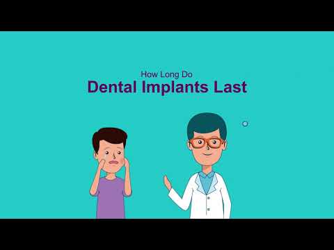 How Long Do Dental Implants Last?