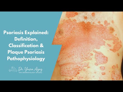 Lecture 1: Psoriasis Explained: Definition, Classification & Plaque Psoriasis Pathophysiology