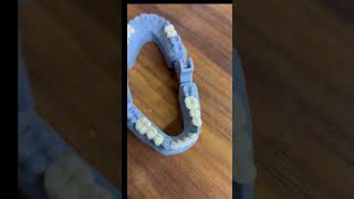 Zirconia ####dentist ##trendigshorts ###viralvideo ###dentalclinic ###dentalartistry