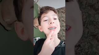 I got Elastics in my Braces!!