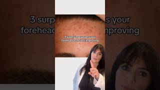 4 reasons why your forehead acne isn’t improving👆🏽 #acne #acnehelp #acneproneskin #acnetreatment