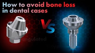 How to avoid bone loss in screw retained restoration? Using dental materials in case