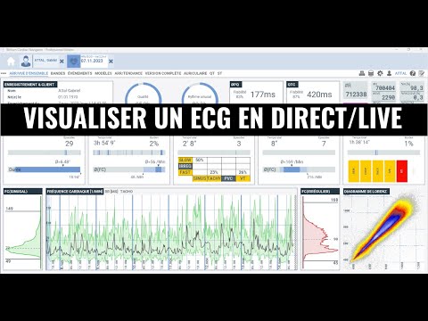 Visualiser le tracé ECG en live
