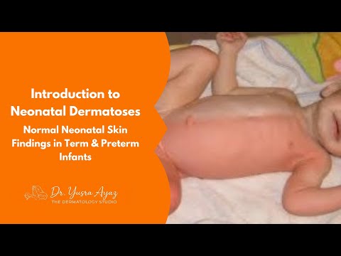 Lecture 1: Introduction to Neonatal Dermatoses: Normal Neonatal Skin Findings in Term & Preterm