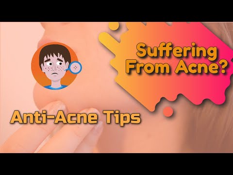 Anti-Acne Tips