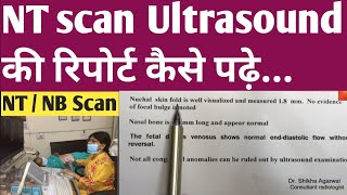 NTscanअल्ट्रासाउंड रिपोर्ट कैसे पढ़ें/What is NT scan/Drshikha NTscan kya hota hai