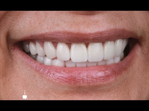 Testimonial Rehabilitación oral