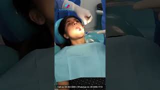 Taking out the upper wisdom teeth in less than 10 minutes without any pain.