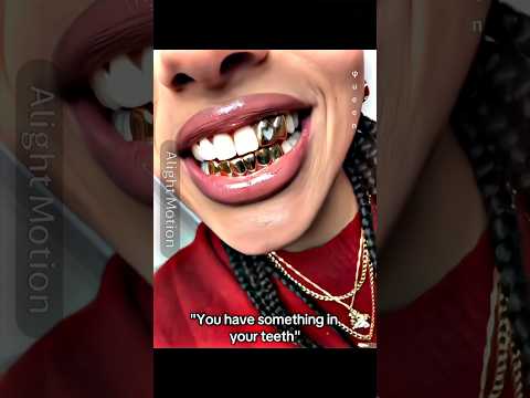 There is something in your teeth 😬 || #queen_9s