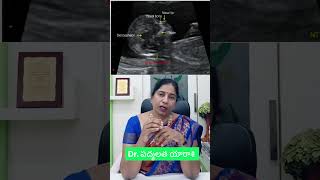 🍼 NT Scan During Pregnancy | Full Details on Crown-Rump Length, Nuchal Translucency #nnox #earlyscan