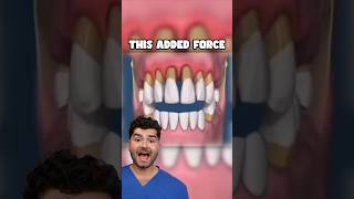 What Would Happen If You Stop Brushing Your Teeth!?