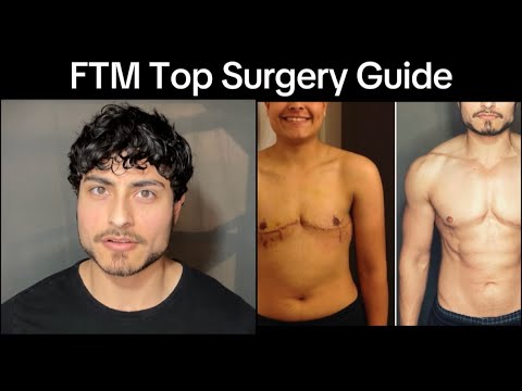 FTM Top Surgery Guide