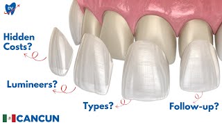 Dental Veneers in Cancun, Mexico: Are They Worth It? Here’s the Real Price