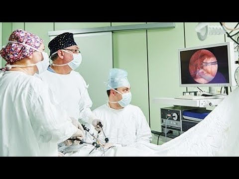 "Exploring Laparoscopy: Minimally Invasive Surgery Revolution | Science for All"