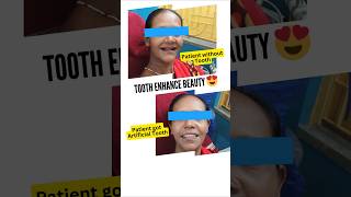 Tooth Enhance your beauty, Save Tooth 🦷😍#shorts #dentist #tooth #dentalclinic