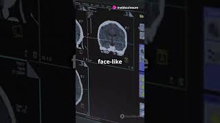 Why Do We See Faces in Everyday Objects? | Neuroscience Explained #neuroscience #sciencefather