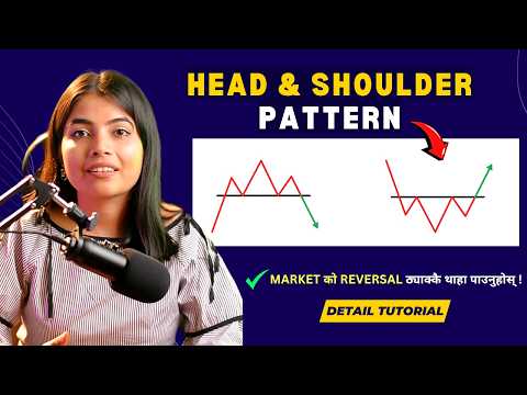 Head & Shoulder Pattern | Full Tutorial Video | Nepal Share Market| CA Supriya Sharma