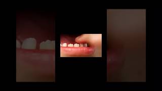 How to remove a baby tooth #shorts #shortsfeed #shortsviral #youtubeshorts #dentistry  #dental